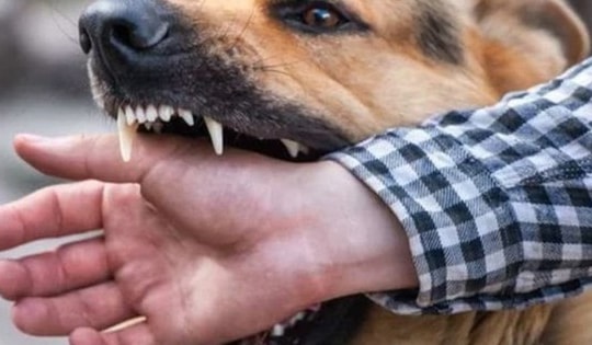 Người đàn ông 38 tuổi ở Đồng Nai tử vong do bị chó cắn nhưng chủ quan không tiêm phòng dại