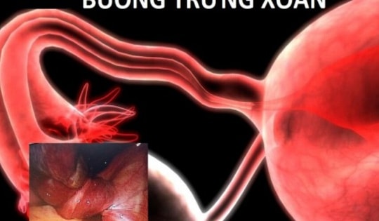 Bé 13 tuổi ở Bình Dương suýt bị hoại tử buồng trứng từ dấu hiệu nhiều người Việt bỏ qua