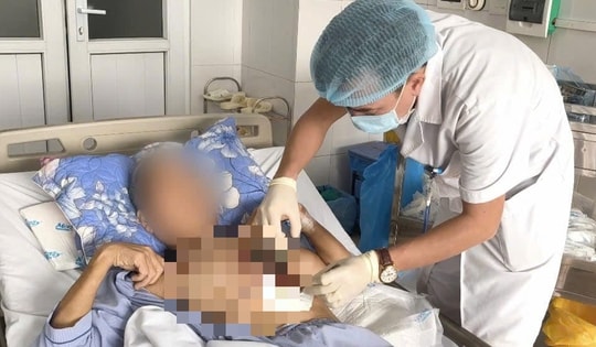 Nhiễm loại nấm hiếm gặp, người đàn ông 60 tuổi ở Tuyên Quang bị hoại tử vùng ngực