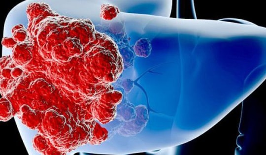 Bất ngờ 6 bệnh ung thư thường gặp có thể ngăn ngừa nhờ tập thể dục, người Việt nên áp dụng ngay để kéo dài tuổi thọ