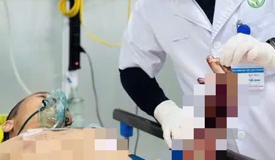 Người đàn ông ở Tuyên Quang phải cắt cụt chi do nổ bình gas khi đang nấu ăn