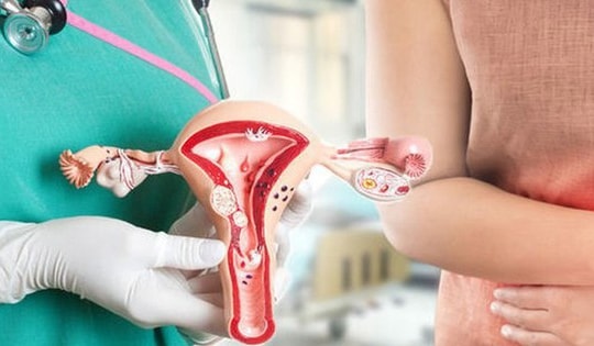 7 dấu hiệu cảnh báo ung thư phụ khoa, chị em tuyệt đối không bỏ qua