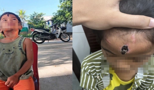 Cha dượng hành hạ con riêng 7 tuổi của vợ