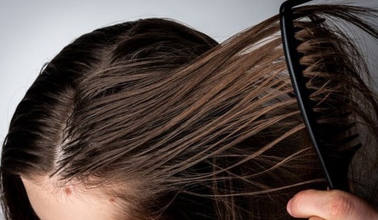 Tóc dầu có nên gội đầu hàng ngày hay không?