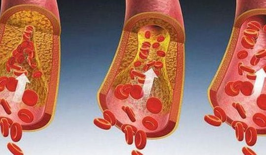 Người mắc các bệnh về chuyển hóa ăn Tết nhất định phải biết điều này để bảo vệ sức khỏe