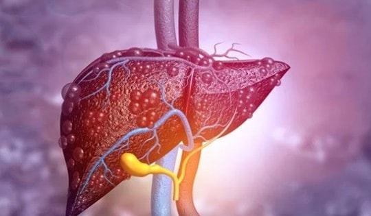 Thải độc gan sau Tết bằng thực phẩm rẻ tiền, an toàn và hiệu quả, rất nhiều người Việt bỏ qua