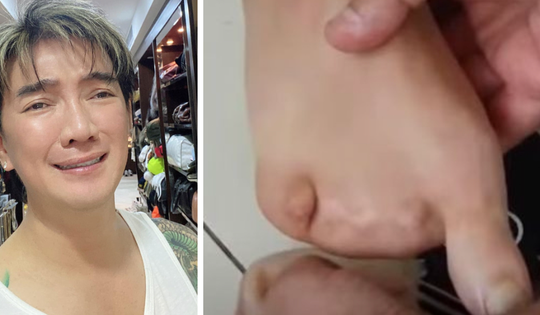 Xôn xao hình ảnh bàn chân bị biến dạng của Đàm Vĩnh Hưng