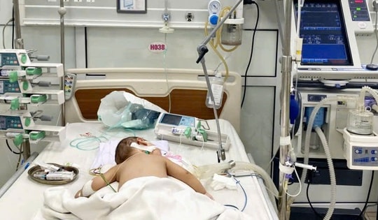 Bé trai 7 tháng tuổi suy hô hấp cấp tiến triển do biến chứng cúm A