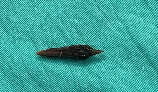 Người phụ nữ 37 tuổi đi cấp cứu sau khi nuốt hạt táo đỏ