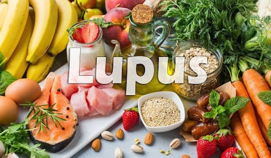 Người bệnh lupus ban đỏ nên ăn gì để kiểm soát tốt bệnh?
