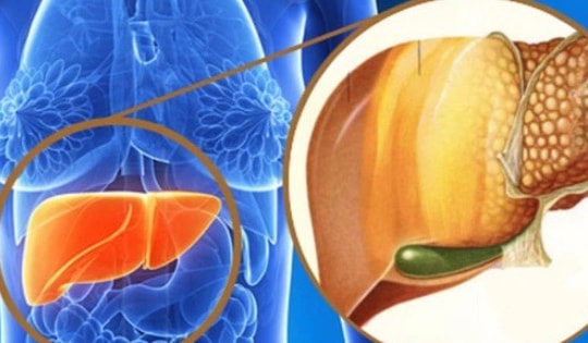 Bệnh gan nhiễm mỡ nguy hiểm thế nào và cần làm ngay điều gì để phòng bệnh sau Tết?