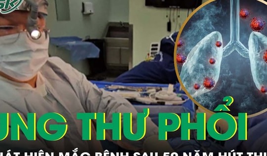 Phát hiện mắc ung thư phổi sau 50 năm hút thuốc lào