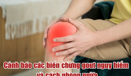 Cảnh báo các biến chứng gout và cách phòng ngừa