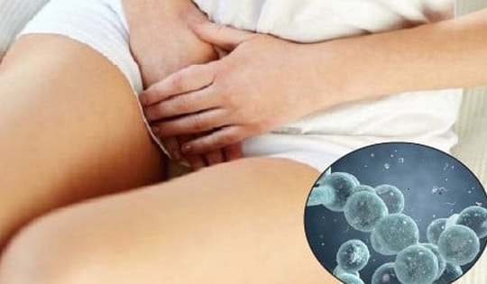 Nhiễm nấm Candida có gây vô sinh không?