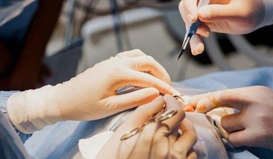 Người phẫu thuật thẩm mỹ gương mặt cần làm việc này để tránh gặp rắc rối khi làm thủ tục xuất nhập cảnh