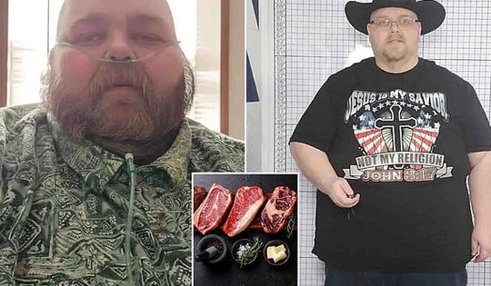 Người đàn ông chỉ ăn thịt và trứng suốt nửa năm, đi khám bác sĩ phải thốt lên một điều