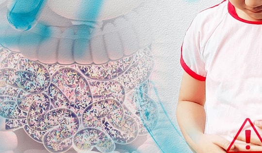 Bé trai 4 tuổi bị hoại tử ruột, phải cắt bỏ một phần ruột: Tất cả vì thói quen sai lầm này sau khi ăn