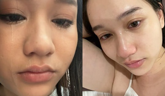 Trúc Anh (Mắt Biếc) thừa nhận bị trầm cảm, công khai những hình ảnh gây xót xa khi tăng cân