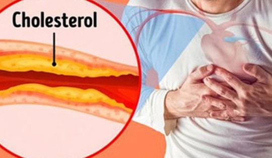 6 biến chứng đáng sợ của bệnh rối loạn mỡ máu
