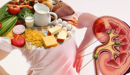 Không chỉ muối, đây là nhóm thực phẩm người bệnh thận nên kiêng để kéo dài tuổi thọ