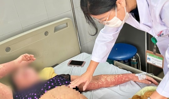 Người phụ nữ bị ngứa dữ dội, mặt sưng phù sau khi uống thuốc