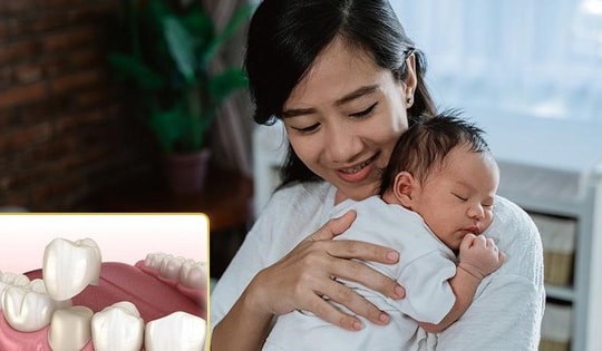 Đang cho con bú có bọc răng sứ được không?