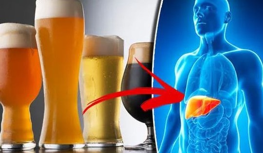 3 loại nước có khả năng ‘giết’ lá gan, hại chẳng kém rượu bia: Nhiều người vẫn uống mỗi ngày