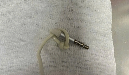 Ca cấp cứu hi hữu: Jack cắm kèm dây cáp tai nghe trong vùng kín nam thanh niên