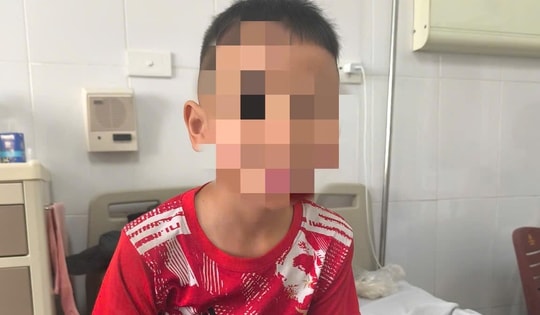 Bé trai 8 tuổi ở Hà Nội phát hiện bệnh phổi hiếm gặp sau một cú ngã trong giờ ra chơi