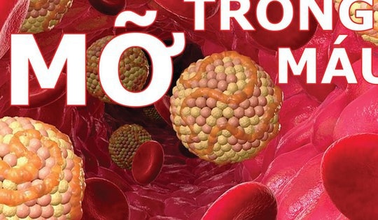 Dùng thuốc trị tăng mỡ máu ở người bệnh đái tháo đường như thế nào?