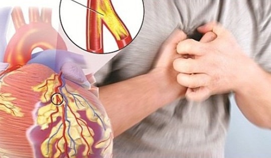 Thuốc điều trị lóc tách động mạch chủ