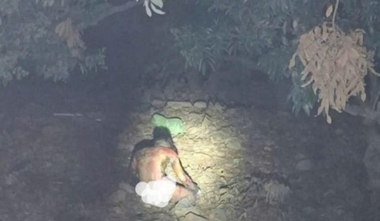 Điều tra vụ việc người đàn ông bị bỏng nặng cạnh trạm biến áp