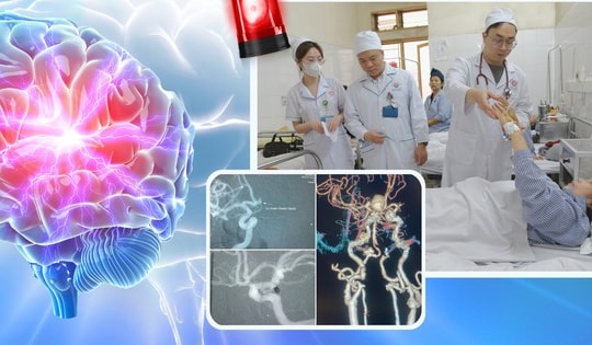 Người phụ nữ ở Quảng Ninh bị đột quỵ sau cơn đau đầu dữ dội, thừa nhận một sai lầm nhiều người Việt mắc phải