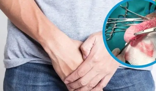 Con trai 8 tuổi nghịch dại, bố 51 tuổi đau đớn vì bị vỡ đôi tinh hoàn