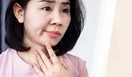 Chế độ dinh dưỡng chăm sóc người bị liệt mặt