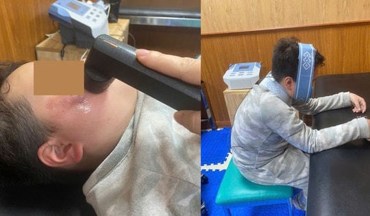 Bé trai thương tích nặng do chó nhà cắn: Tiết lộ đáng sợ về ‘thủ phạm’