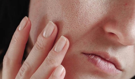 Da dầu có lão hóa chậm hơn da khô?