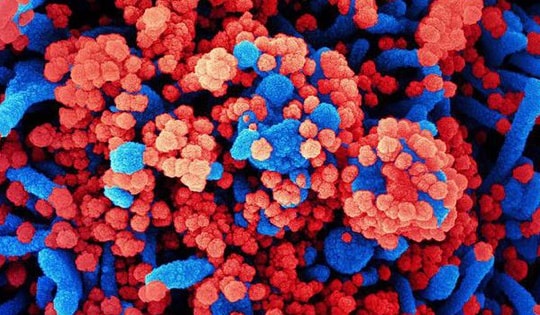 Nga lên tiếng về loại virus chưa xác định gây ra tình trạng ho ra máu