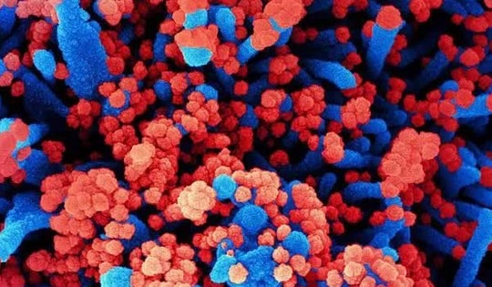 Nga lên tiếng về loại virus chưa xác định gây ra tình trạng sốt và ho ra máu