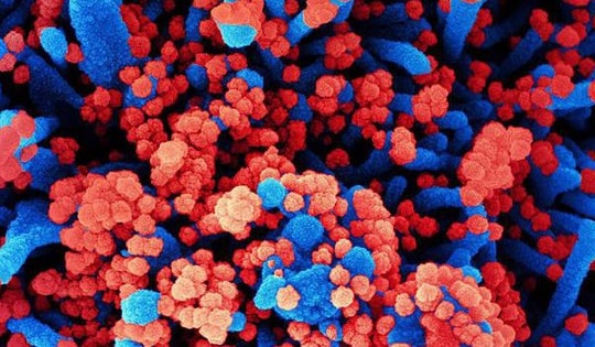 Cục Phòng bệnh thông tin về các trường hợp mắc bệnh chưa rõ nguyên nhân tại Nga