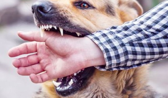 5 người bị chó nghi mắc bệnh dại cắn