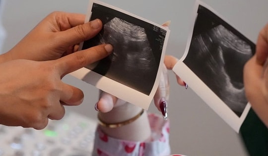 Rút ngắn hành trình tìm con của các cặp vợ chồng vô sinh hiếm muộn