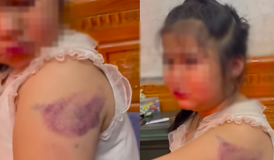 'Lá chắn' nào bảo vệ học sinh khỏi bạo hành từ giáo viên?