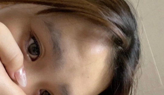 Xác minh vụ nữ sinh bị đánh nhập viện vì mâu thuẫn tiền tip tại nhà hàng ở Hà Nội