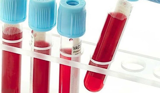 Thuốc điều trị Hội chứng Evans