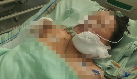 Coi chừng thiệt thân vì chó cắn