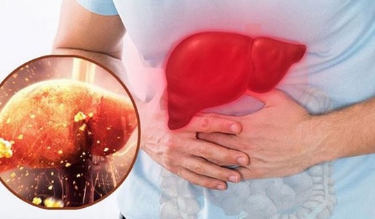 Người đàn ông có chỉ số men gan cao gấp 38 lần thừa nhận một sai lầm mà nhiều người Việt mắc phải