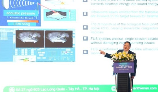 Việt Nam áp dụng công nghệ mới loại bỏ khối u bằng sóng siêu âm hội tụ cường độ cao