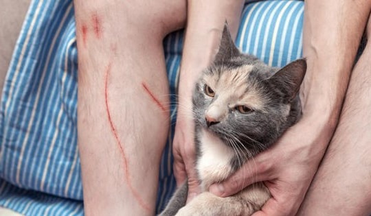 Người đàn ông tử vong sau 2 tháng bị mèo cào vào bắp chân