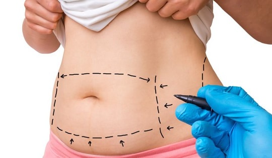 5 phương pháp hiệu quả để siết mỡ bụng